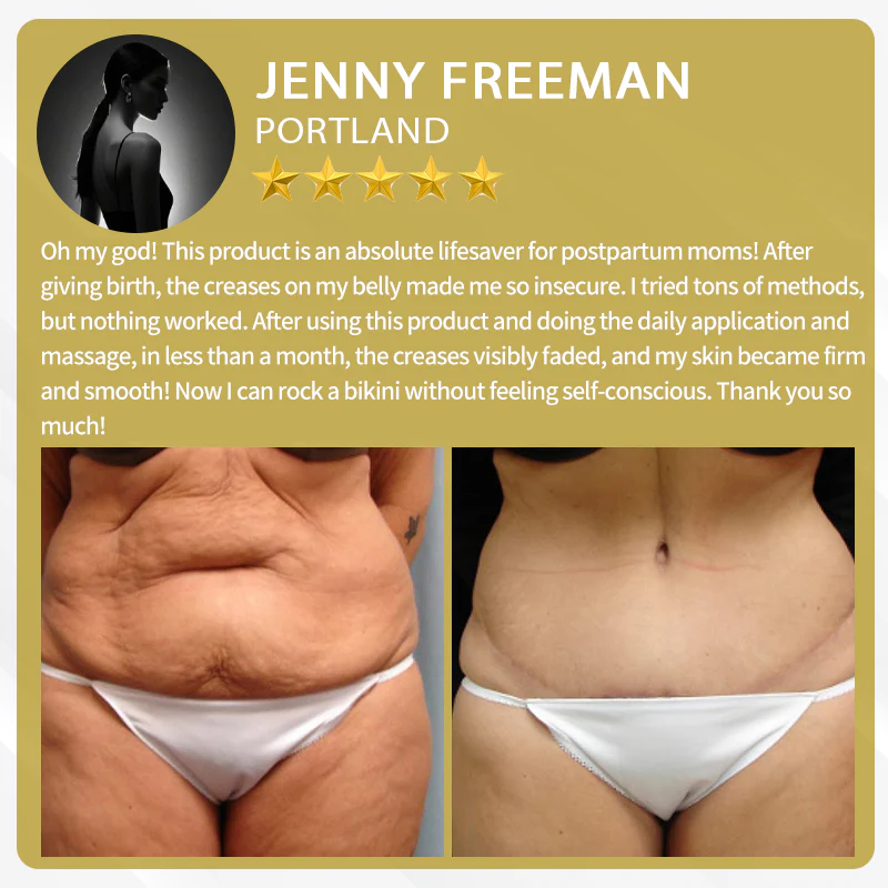 LOVILDS™ Bee Venom Cream — Trusted by Millions for Healthy, Glowing Skin 9 LOVILDS™ Bee Venom Cream — Trusted by Millions for Healthy, Glowing Skin