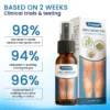 Cvreoz® Herbal Varicose Veins Treatment Spray 3 Cvreoz® Herbal Varicose Veins Treatment Spray