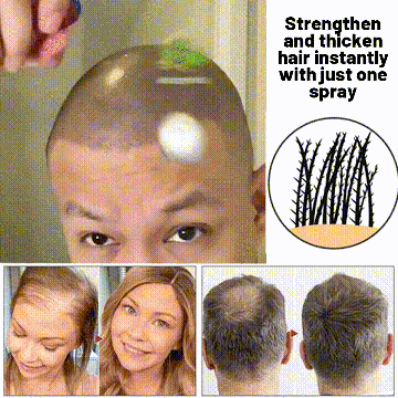 HZA™ Natural Hair Regrowth Spray 11 HZA™ Natural Hair Regrowth Spray