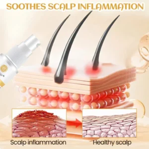 Cvreoz® Ginger Hair Regrowth Serum 16 Cvreoz® Ginger Hair Regrowth Serum