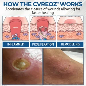CVREOZ® Diabetes Foot Guard Fast Recovery Spray 24 CVREOZ® Diabetes Foot Guard Fast Recovery Spray
