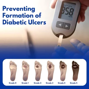 Crveoz® VenHeal Diabetic Wound Cream 11 Crveoz® VenHeal Diabetic Wound Cream