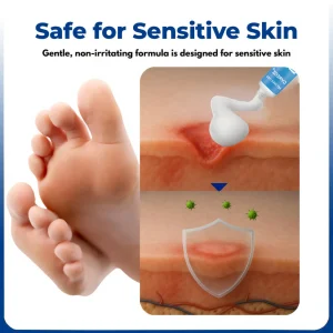 Crveoz® VenHeal Diabetic Wound Cream 17 Crveoz® VenHeal Diabetic Wound Cream