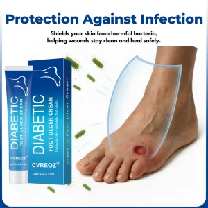 Crveoz® VenHeal Diabetic Wound Cream 16 Crveoz® VenHeal Diabetic Wound Cream