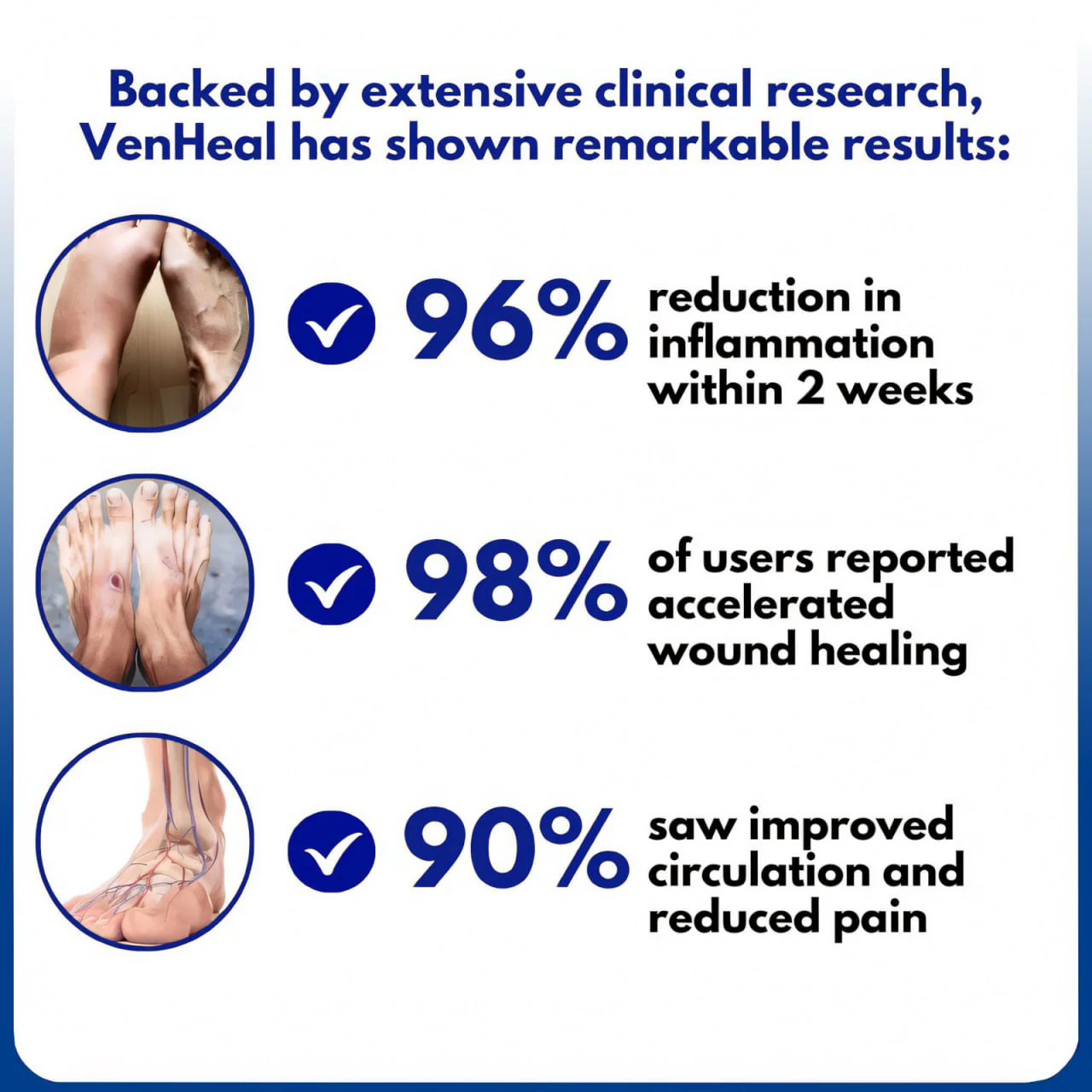 Crveoz® VenHeal Diabetic Wound Cream 3 Crveoz® VenHeal Diabetic Wound Cream - Image 3