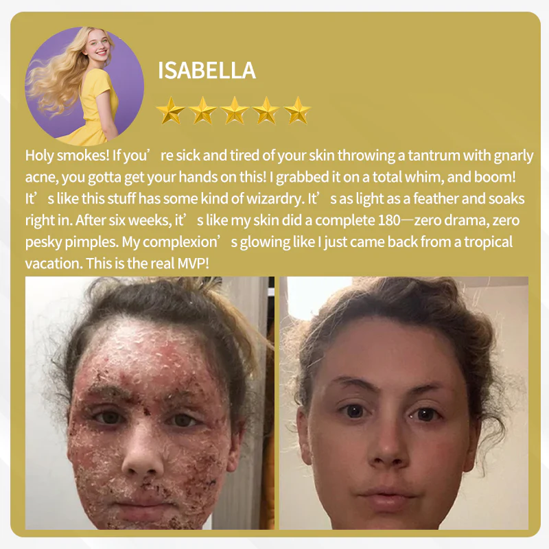 LOVILDS™ Bee Venom Cream — Trusted by Millions for Healthy, Glowing Skin 10 LOVILDS™ Bee Venom Cream — Trusted by Millions for Healthy, Glowing Skin