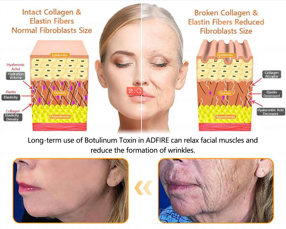 ADFIRE® Bee venom Comprehensive Cream 11 ADFIRE® Bee venom Comprehensive Cream