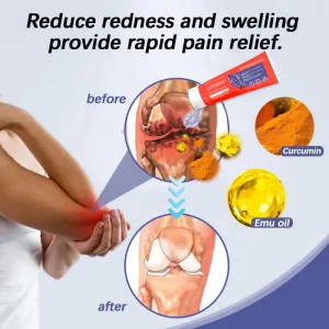 LOTMAY® Turmeric & Emu Oil Arthritis Soothing Pain Relief Massage Gel 19 LOTMAY® Turmeric & Emu Oil Arthritis Soothing Pain Relief Massage Gel