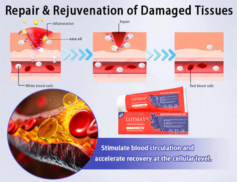 LOTMAY® Turmeric & Emu Oil Arthritis Soothing Pain Relief Massage Gel 9 LOTMAY® Turmeric & Emu Oil Arthritis Soothing Pain Relief Massage Gel
