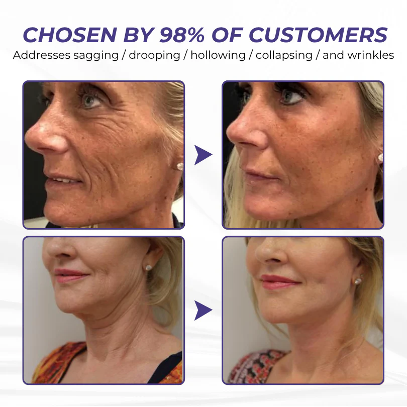 Timilk® ElastaPro Emu Oil Skin Firming Cream 9 Timilk® ElastaPro Emu Oil Skin Firming Cream - Image 9