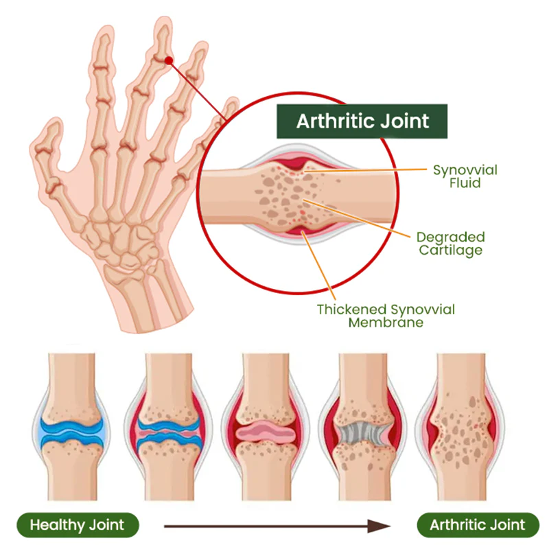 Adfire® Bee Venom Bone & Joint Revive Spray 10 Adfire® Bee Venom Bone & Joint Revive Spray