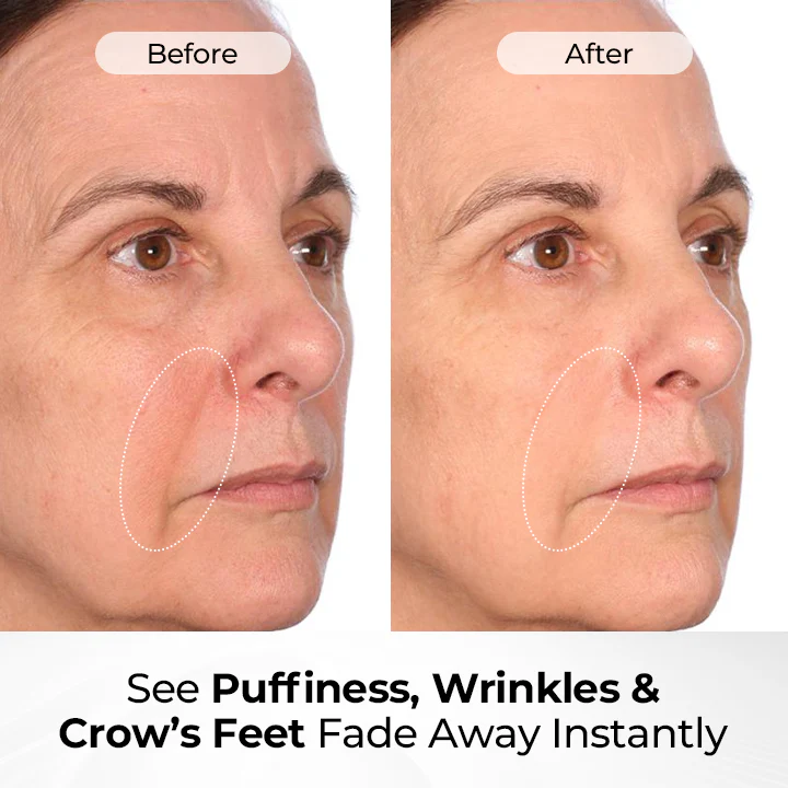 Biancat® TightShift Precision Contour & Firming Serum 5 Biancat® TightShift Precision Contour & Firming Serum