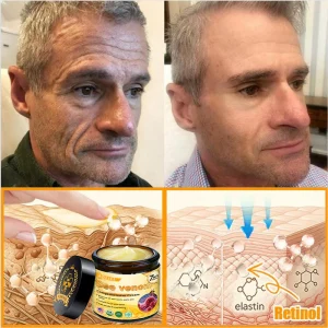 ADFIRE® Bee venom Comprehensive Cream 32 ADFIRE® Bee venom Comprehensive Cream