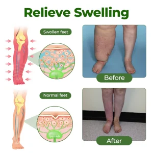 Timilk® Professional Leg Circulation Cream 11 Timilk® Professional Leg Circulation Cream