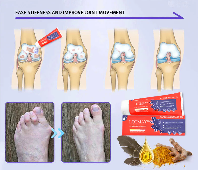 LOTMAY® Turmeric & Emu Oil Arthritis Soothing Pain Relief Massage Gel 11 LOTMAY® Turmeric & Emu Oil Arthritis Soothing Pain Relief Massage Gel