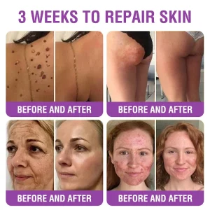 YUNPSO™ Queen Nectar Peptide + Bakuchiol Skin Restoration Cream 28 YUNPSO™ Queen Nectar Peptide + Bakuchiol Skin Restoration Cream