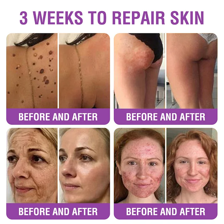 YUNPSO™ Queen Nectar Peptide + Bakuchiol Skin Restoration Cream 11 YUNPSO™ Queen Nectar Peptide + Bakuchiol Skin Restoration Cream