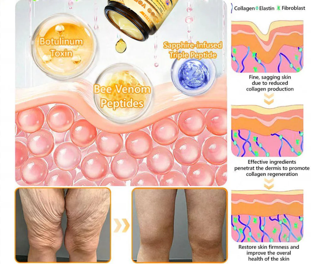 ADFIRE® Bee venom Comprehensive Cream 12 ADFIRE® Bee venom Comprehensive Cream