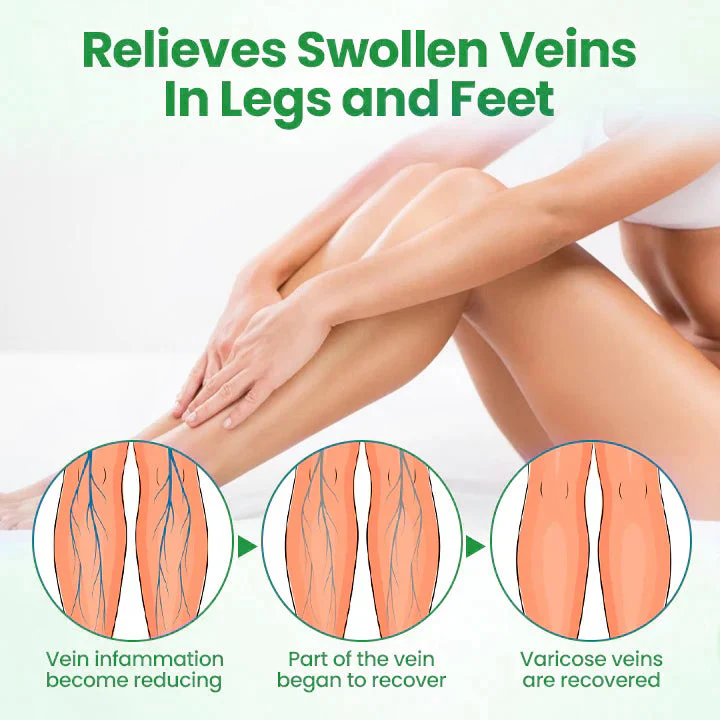 ADFIRE® VeinGuard Herbal Spray 5 ADFIRE® VeinGuard Herbal Spray