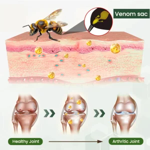 Adfire® Bee Venom Bone & Joint Revive Spray 18 Adfire® Bee Venom Bone & Joint Revive Spray