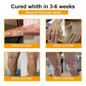 ADFIRE® Bee Venom Pain-Relief Bone Healing Spray 29 ADFIRE® Bee Venom Pain-Relief Bone Healing Spray