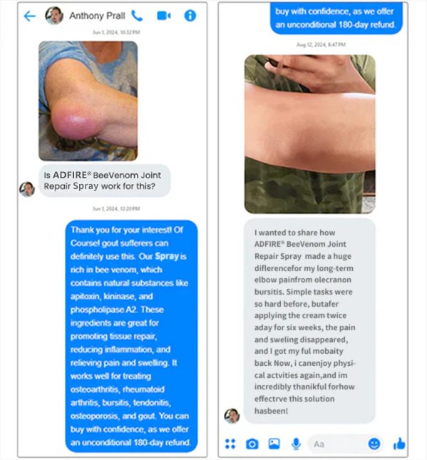 Adfire® Bee Venom Bone & Joint Revive Spray 4 Adfire® Bee Venom Bone & Joint Revive Spray