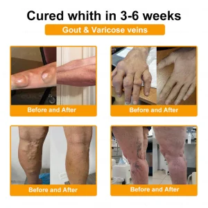 ADFIRE® Bee Venom Pain-Relief Bone Healing Spray 28 ADFIRE® Bee Venom Pain-Relief Bone Healing Spray