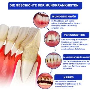 Dobshow® Bee Venom Dental Microgranules 15 Dobshow® Bee Venom Dental Microgranules