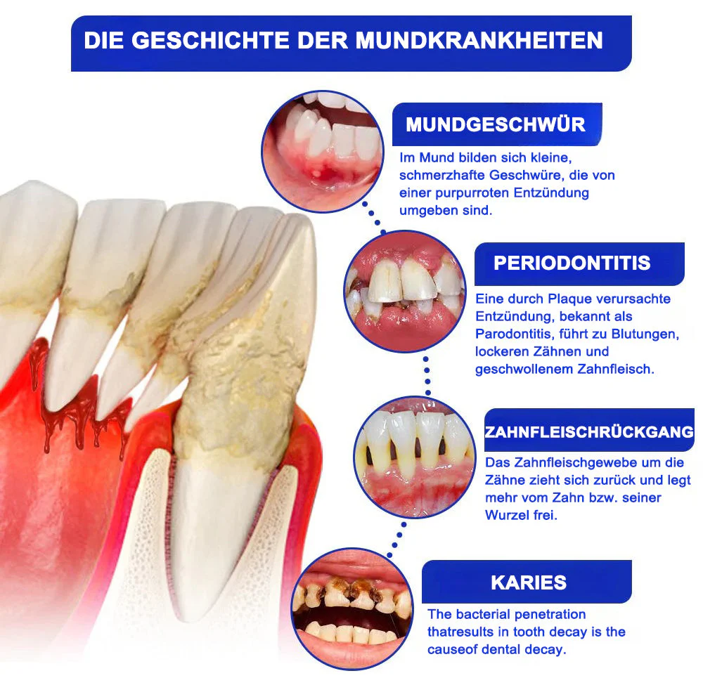 Dobshow® Bee Venom Dental Microgranules 8 Dobshow® Bee Venom Dental Microgranules - Image 8