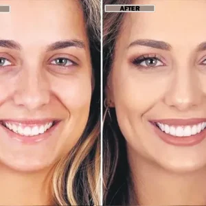 NESLEMY™Coconut Whitening Strips 19 NESLEMY™Coconut Whitening Strips