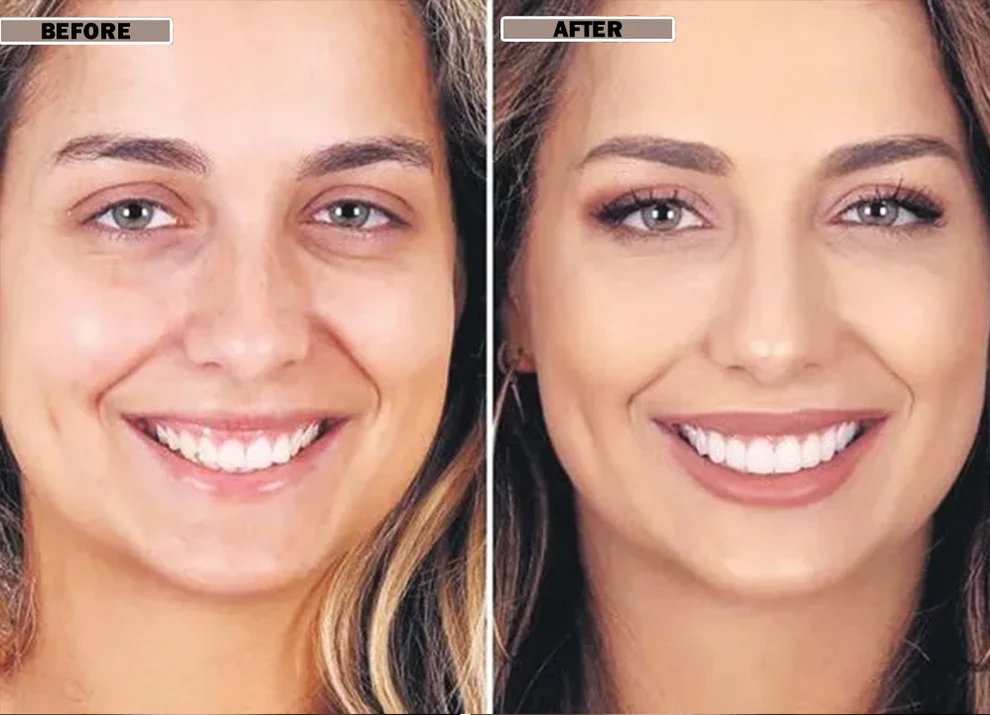 NESLEMY™Coconut Whitening Strips 9 NESLEMY™Coconut Whitening Strips