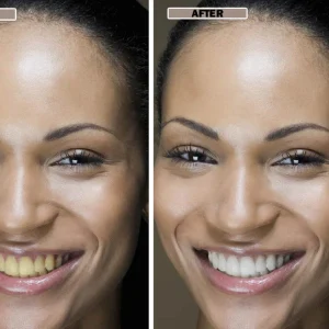 NESLEMY™Coconut Whitening Strips 17 NESLEMY™Coconut Whitening Strips