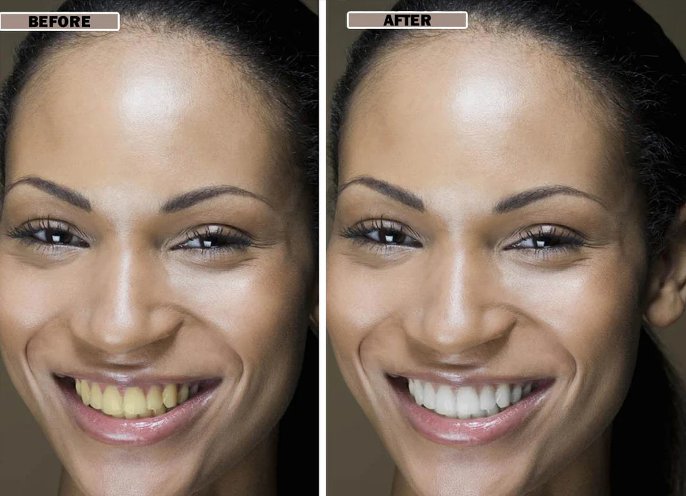 NESLEMY™Coconut Whitening Strips 7 NESLEMY™Coconut Whitening Strips