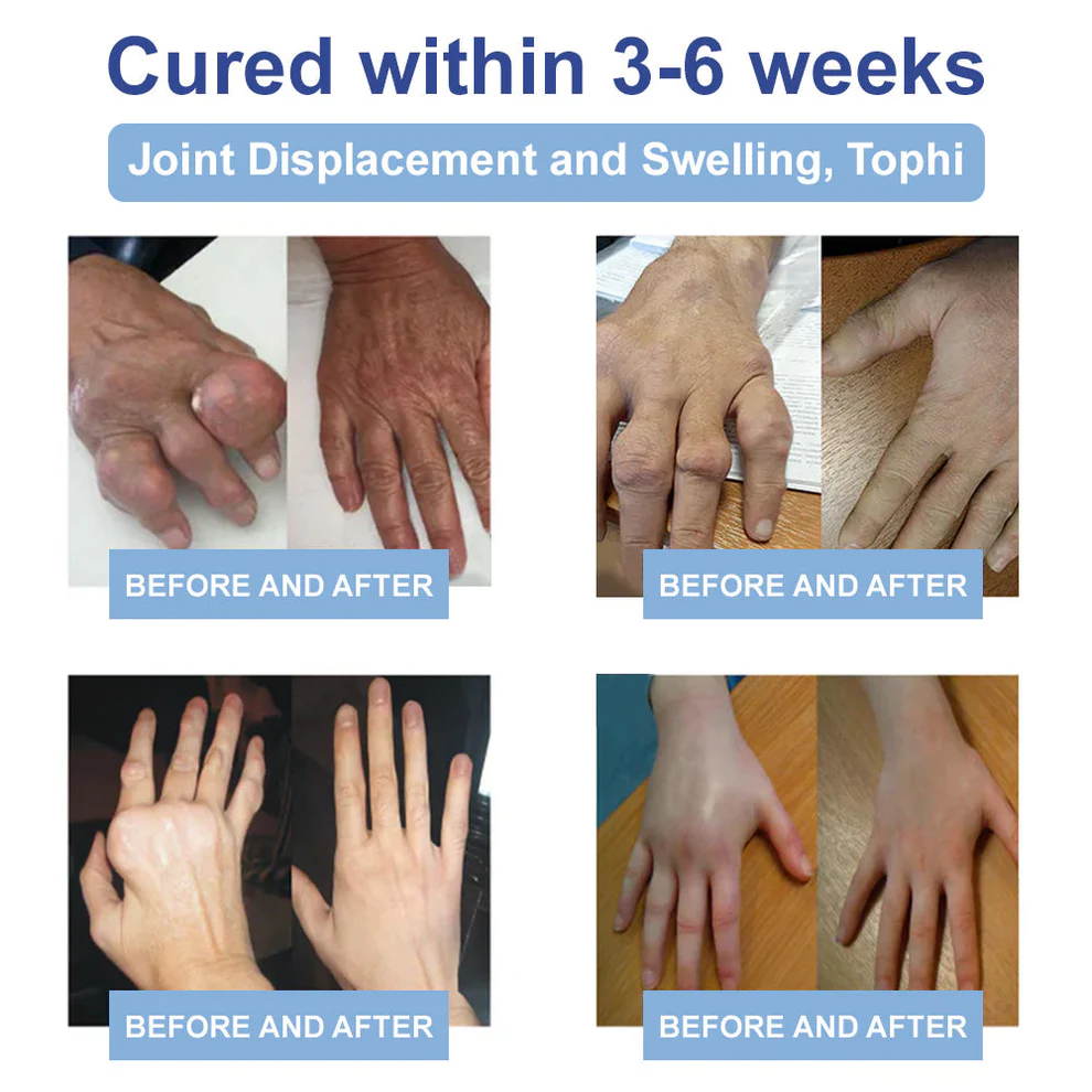 Skavix® Advanced Magnesium Pain Relief Cream 5 Skavix® Advanced Magnesium Pain Relief Cream