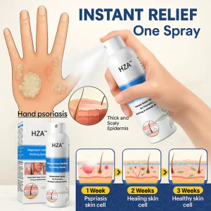 HZA™ Magnesium Herbal Psoriasis Spray 15 HZA™ Magnesium Herbal Psoriasis Spray