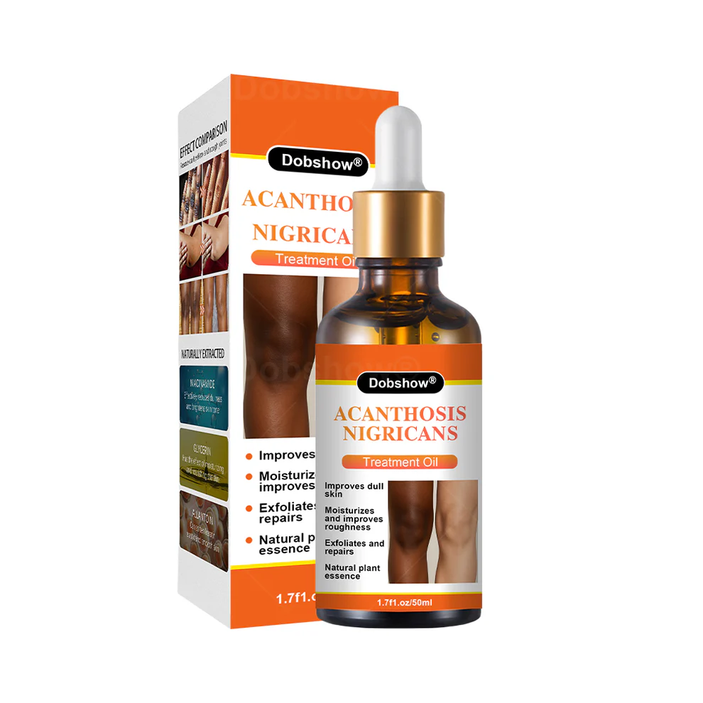 Dobshow® Acanthosis Nigricans Treatment Oil 11 Dobshow® Acanthosis Nigricans Treatment Oil