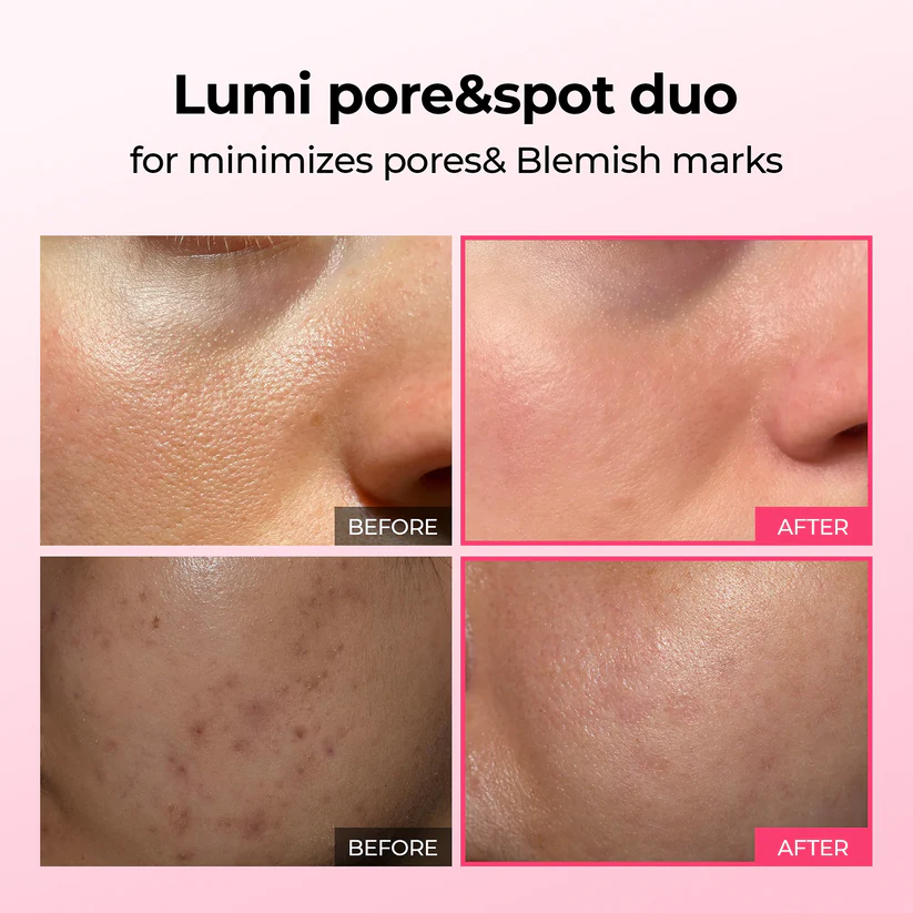 LUHAKA® Pore & Spot Care Duo 3 LUHAKA® Pore & Spot Care Duo