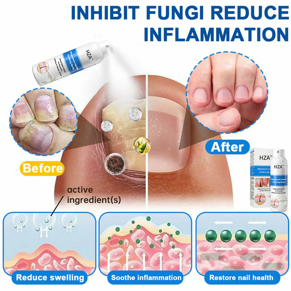 HZA™ Magnesium Herbal Psoriasis Spray 5 HZA™ Magnesium Herbal Psoriasis Spray