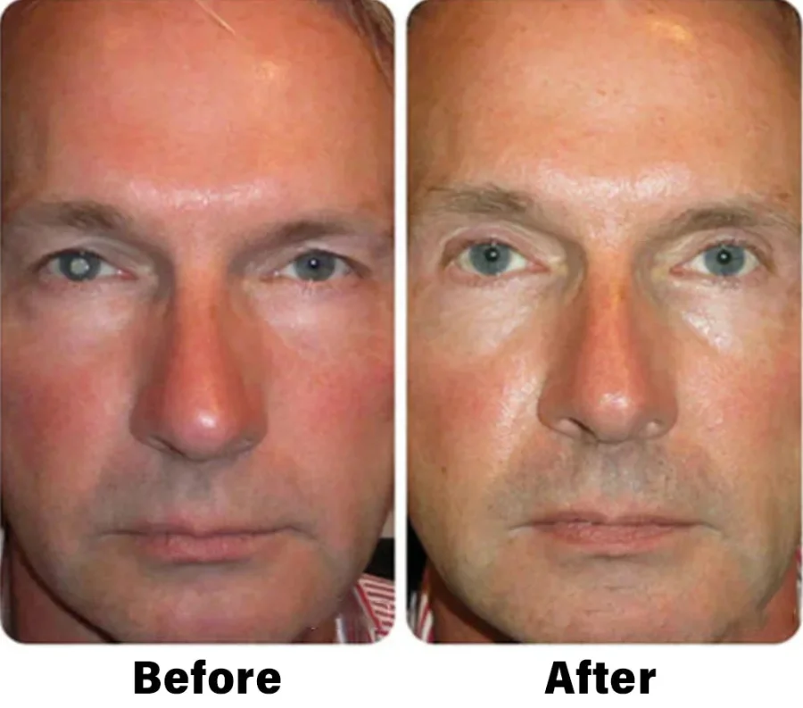 NESLEMY™ Nano Vision Repair Eye Serum 5 NESLEMY™ Nano Vision Repair Eye Serum