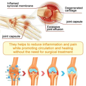 ADFIRE® Bee Venom Pain-Relief Bone Healing Spray 37 ADFIRE® Bee Venom Pain-Relief Bone Healing Spray