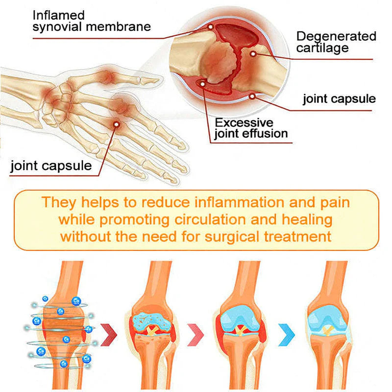 ADFIRE® Bee Venom Pain-Relief Bone Healing Spray 13 ADFIRE® Bee Venom Pain-Relief Bone Healing Spray