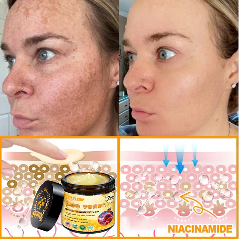 ADFIRE® Bee venom Comprehensive Cream 15 ADFIRE® Bee venom Comprehensive Cream