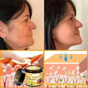 ADFIRE® Bee venom Comprehensive Cream 30 ADFIRE® Bee venom Comprehensive Cream