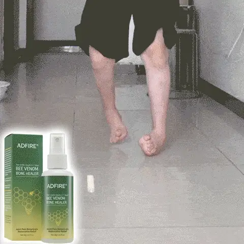 Adfire® Bee Venom Bone & Joint Revive Spray 2 Adfire® Bee Venom Bone & Joint Revive Spray