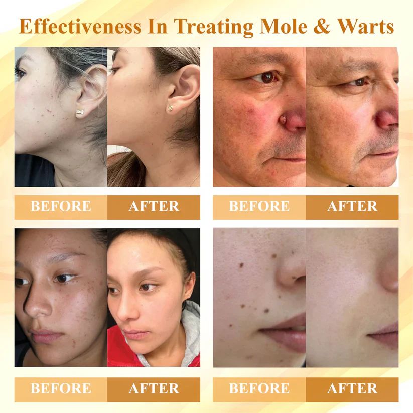 Cvreoz® Condense Mellifera Venom Skin Repairing Cream 2 Cvreoz® Condense Mellifera Venom Skin Repairing Cream