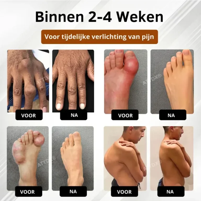 MagniBee™ Joint Support Formula Aerosol | Relieves stiff joints 11 MagniBee™ Joint Support Formula Aerosol | Relieves stiff joints