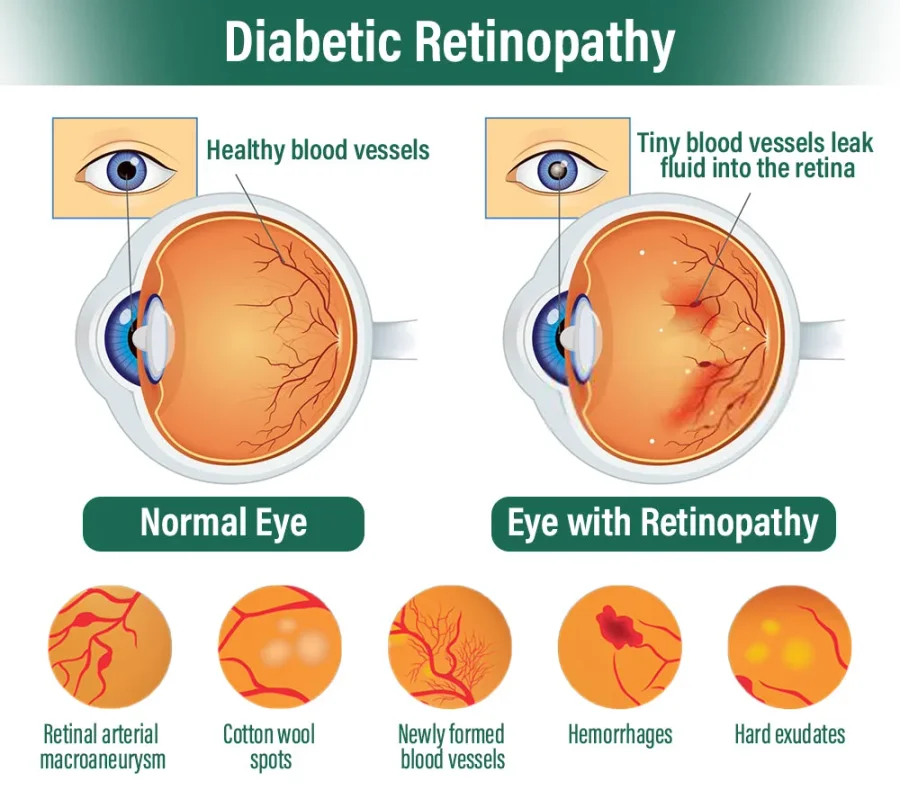 NESLEMY™ Nano Vision Repair Eye Serum 15 NESLEMY™ Nano Vision Repair Eye Serum
