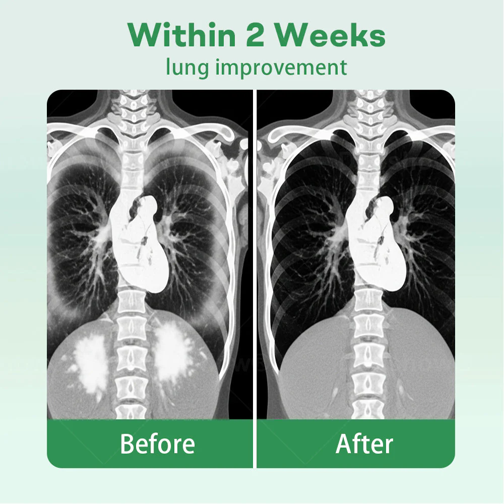 Cvreoz® Herbal Lung Cleansing Inhaler 3 Cvreoz® Herbal Lung Cleansing Inhaler