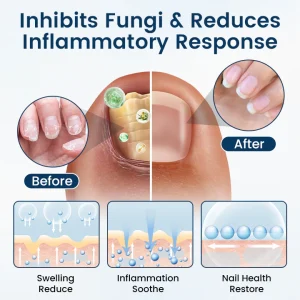 Timilk® OnyxiGuard Fungal Repair Herbal Spray 10 Timilk® OnyxiGuard Fungal Repair Herbal Spray