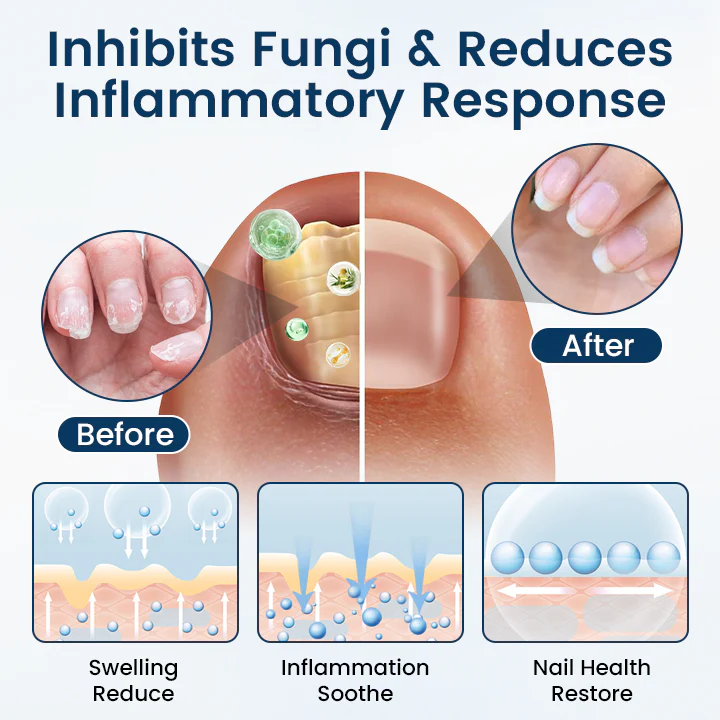 Timilk® OnyxiGuard Fungal Repair Herbal Spray 3 Timilk® OnyxiGuard Fungal Repair Herbal Spray - Image 3